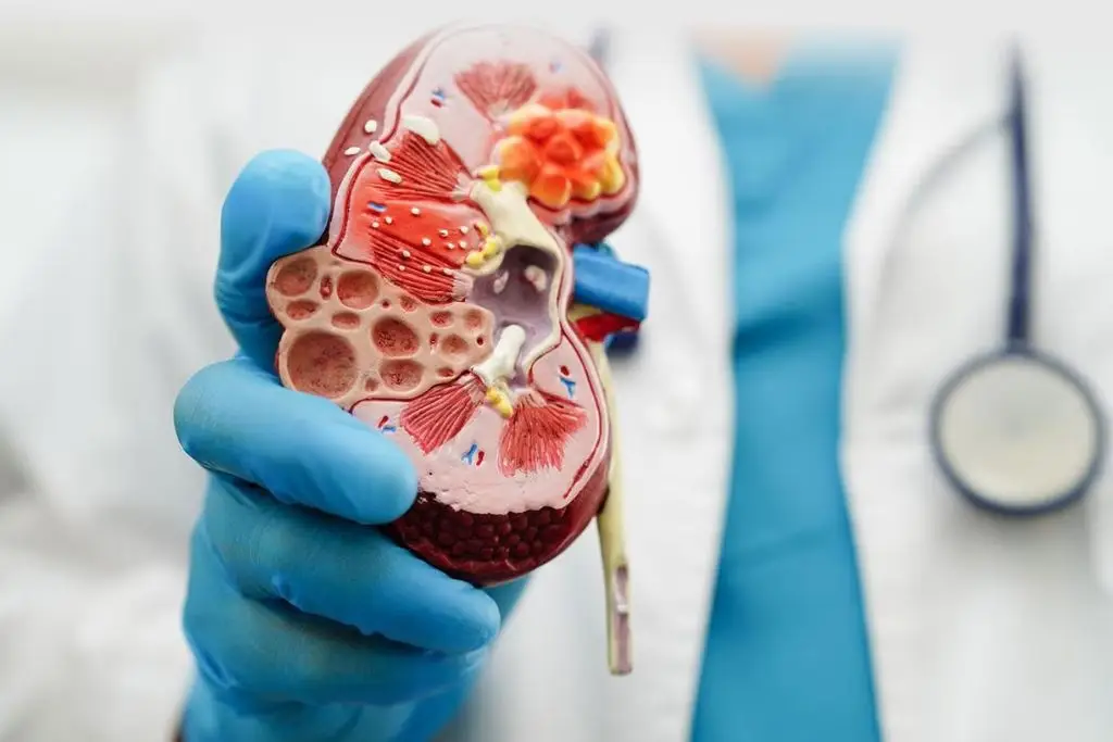 Imagen relacionada a la nota