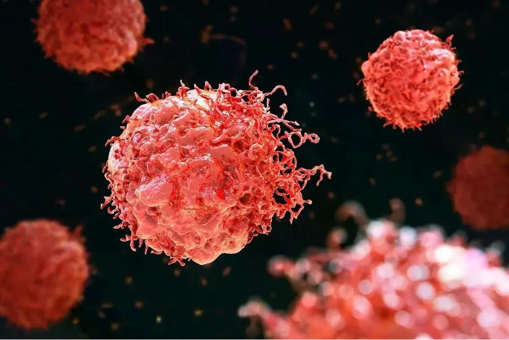 Imagen relacionada a la nota