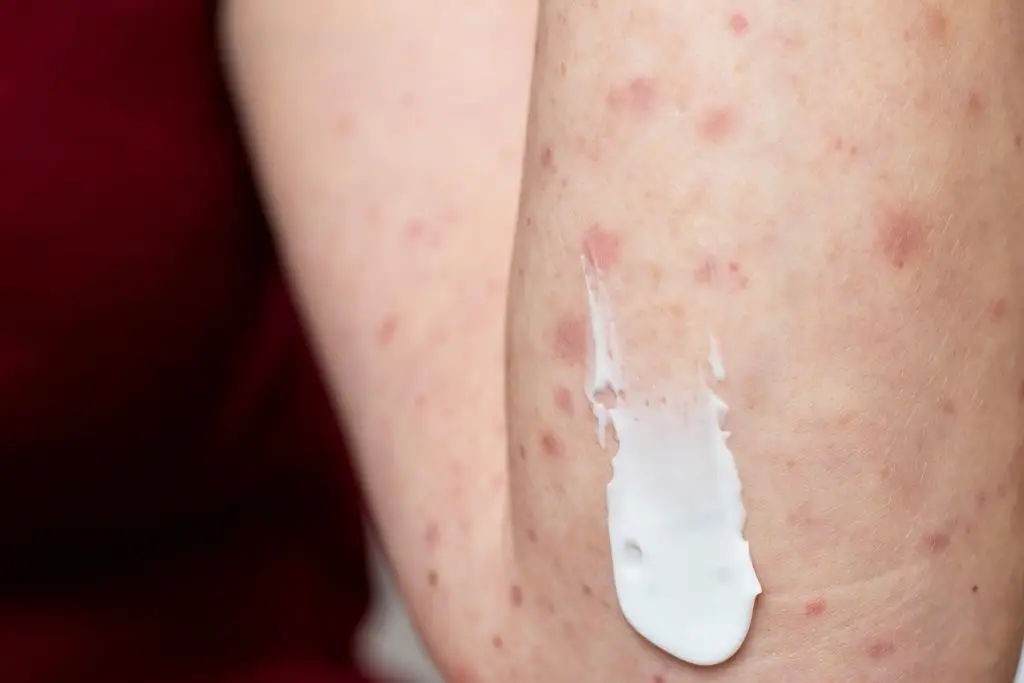 Imagen relacionada a la nota