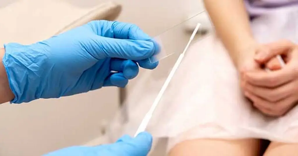 Imagen relacionada a la nota