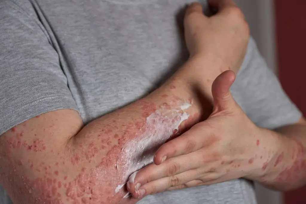 Imagen relacionada a la nota