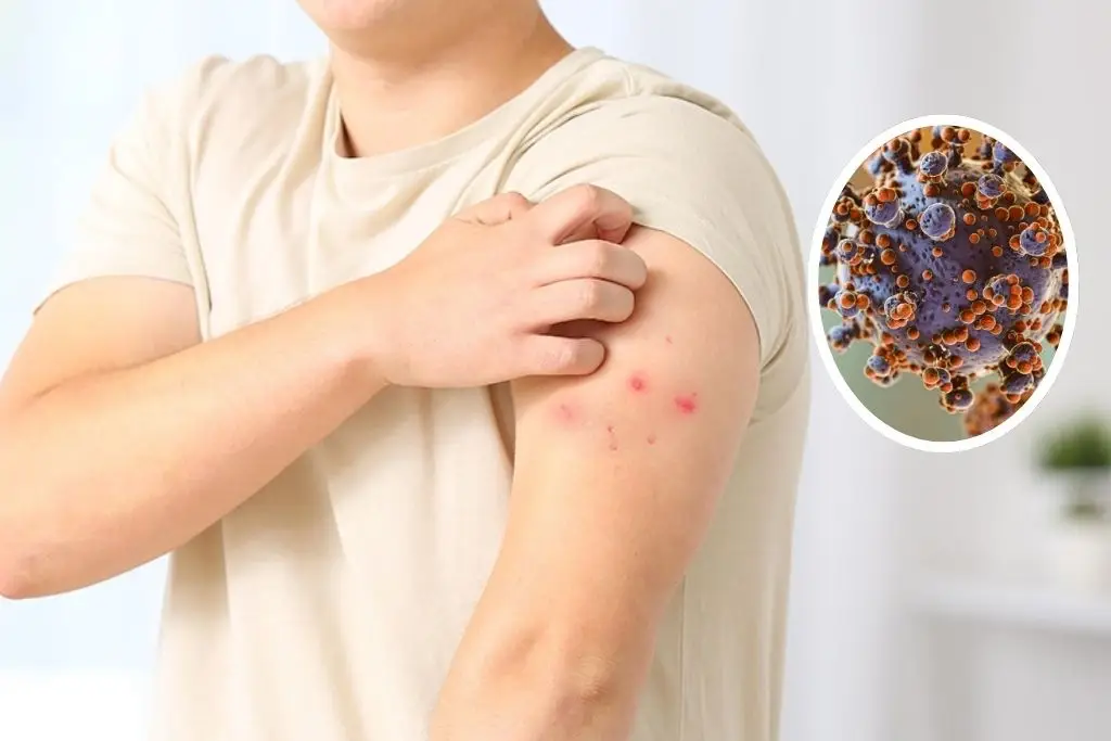 Imagen relacionada a la nota