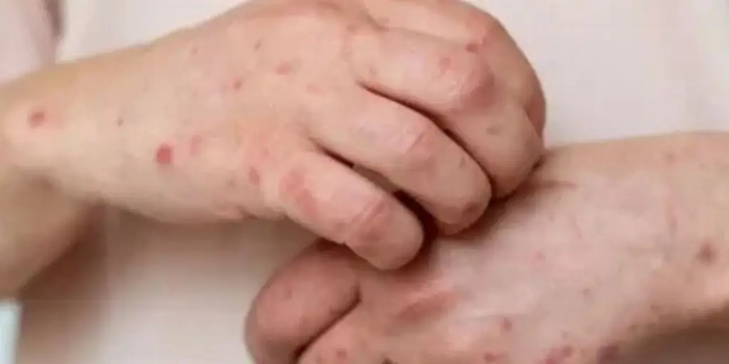 Imagen relacionada a la nota