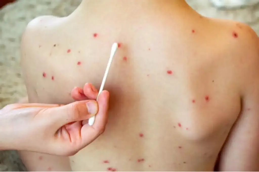 Imagen relacionada a la nota