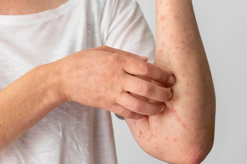 Imagen relacionada a la nota