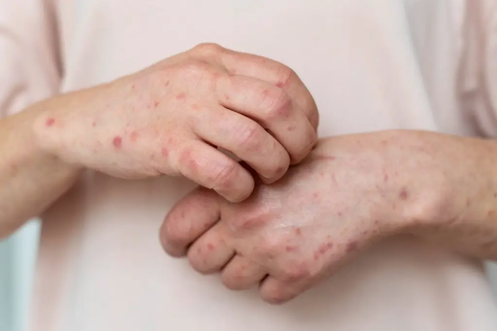 Imagen relacionada a la nota