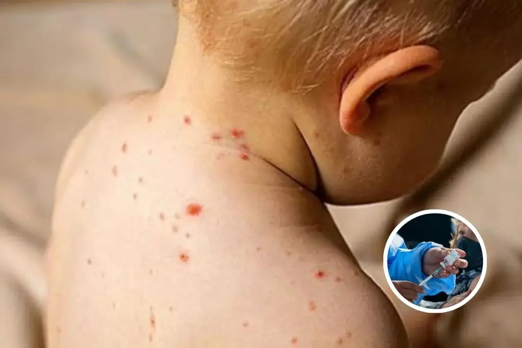 Imagen relacionada a la nota