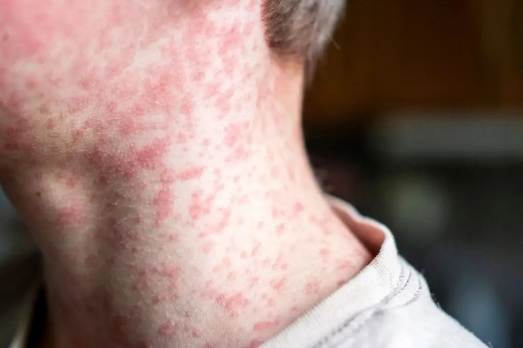 Imagen relacionada a la nota