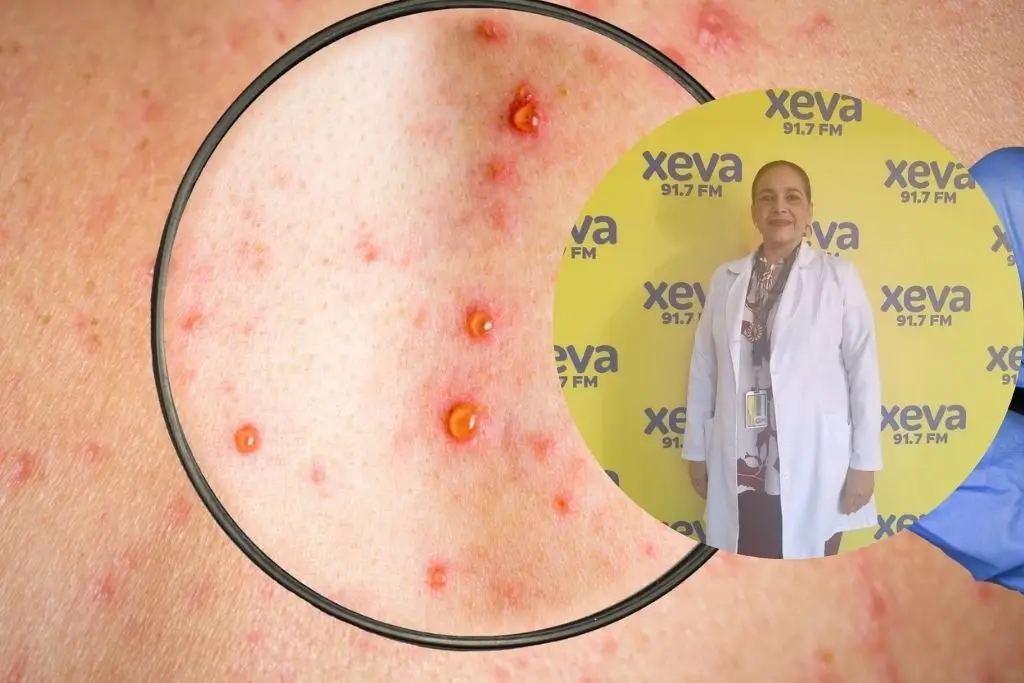 Imagen relacionada a la nota