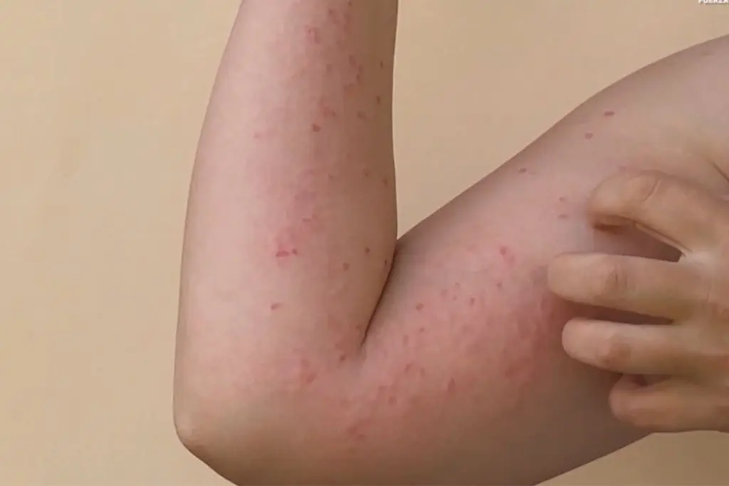 Imagen relacionada a la nota