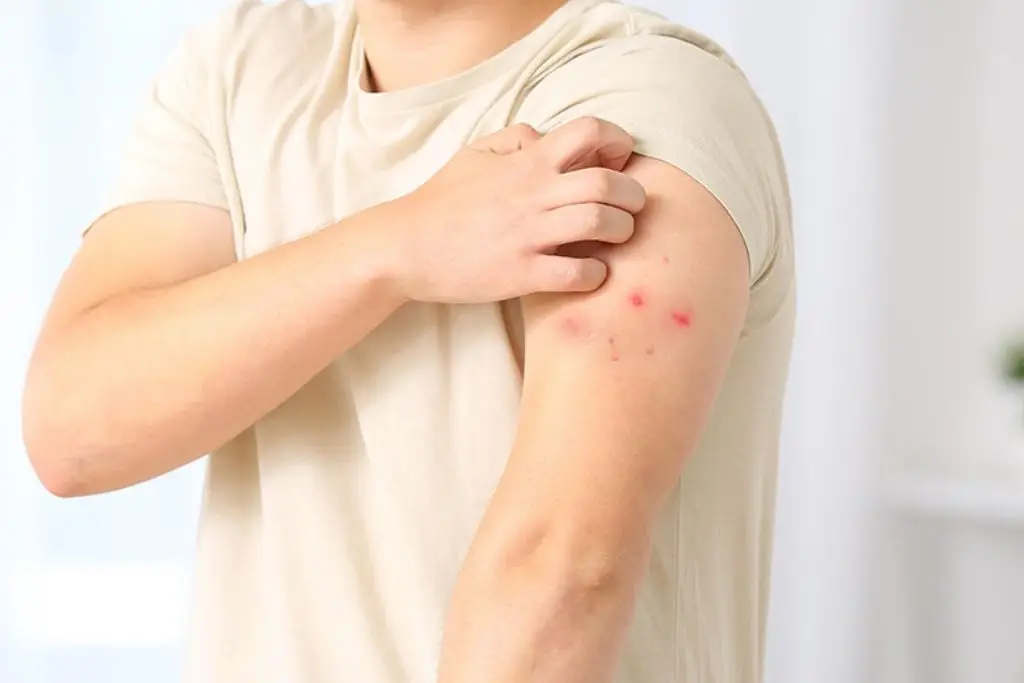 Imagen relacionada a la nota