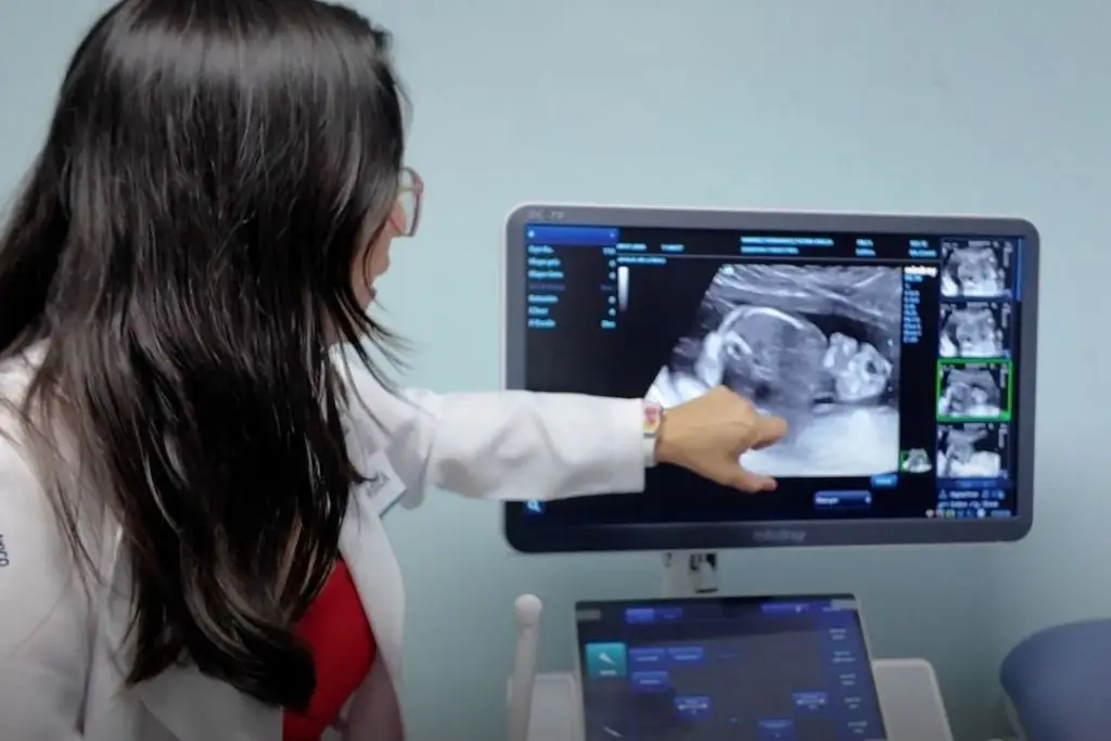 Imagen relacionada a la nota