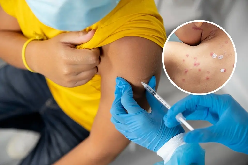 Participa en el sondeo